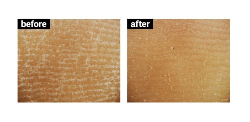 角質ケア ボディスクラブおすすめ イメージ