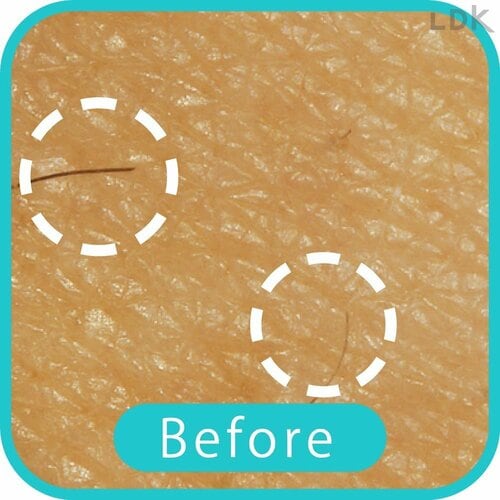 Before 女性用電気シェーバーおすすめ イメージ