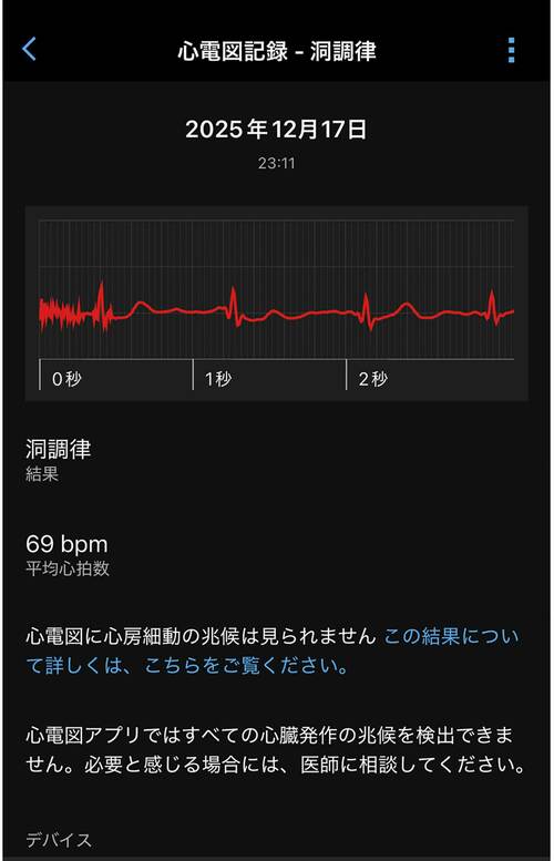 詳細ログで身体をサポート スマートウォッチおすすめ イメージ