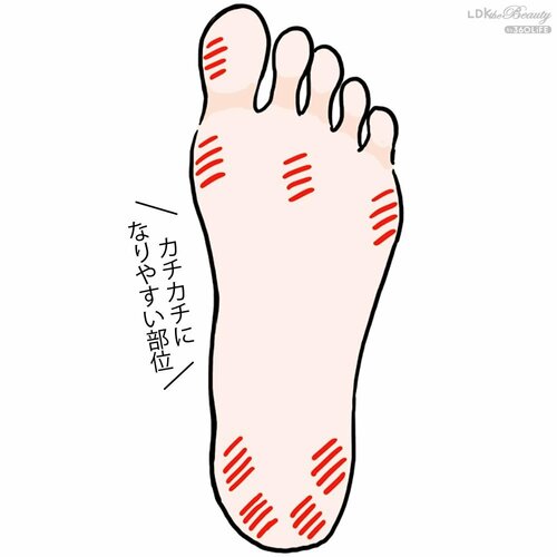 乾燥、冷え、摩擦も原因 かかとクリームおすすめ イメージ