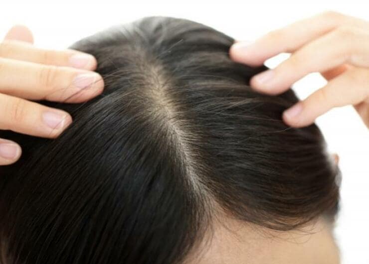 【頭皮ケア】食生活も見直し！頭皮環境が悪化する原因って？｜『LDK』とプロが紹介