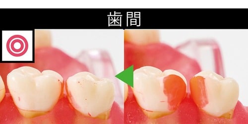 ポイント1:奥歯や歯間の歯垢をやわらか毛先でキャッチ! イメージ4