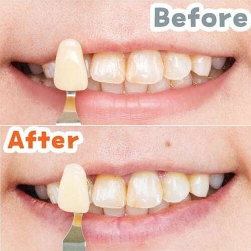 リアルモニターの歯 LDKベストバイ2025おすすめ イメージ