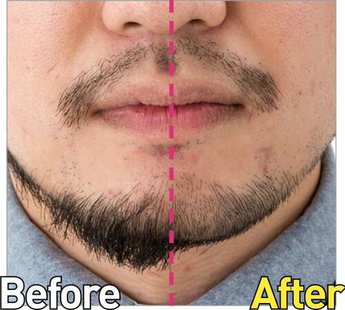 落ちるヒゲの量が圧倒的に減ります！ イメージ4