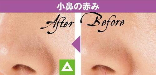 4位: コンシーラーというよりハイライト使いがおすすめ コンシーラーおすすめ イメージ3