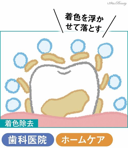 歯の美白、ホームケアには限界がある? ホワイトニング歯磨き粉おすすめ イメージ