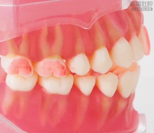 Before 安い電動歯ブラシおすすめ イメージ