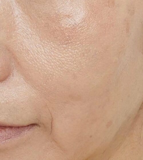 シミや肝斑を目立たせるカラー 50代・60代向けハイライトおすすめ イメージ