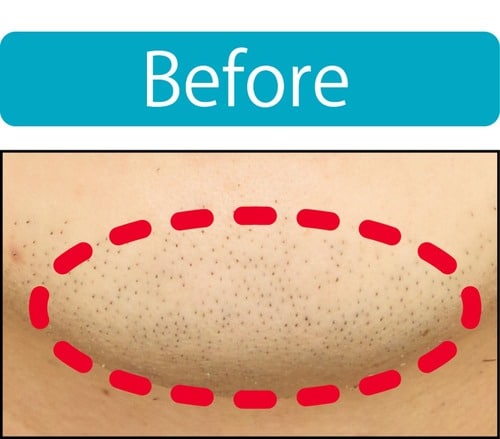 【青ヒゲ隠し】粉っぽくならずに薄くできた メンズコンシーラーおすすめ イメージ