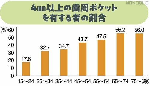 40代の2人に1人が歯周病 イメージ