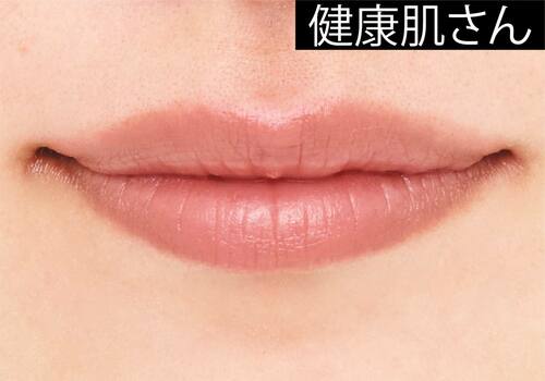 健康肌さん ソフトマットリップおすすめ イメージ