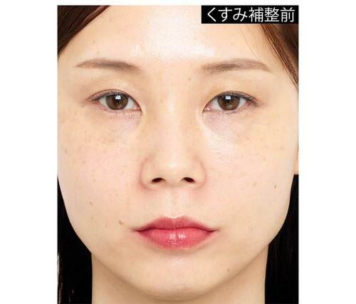 【Before】くすみ補正前 青みピンクリップおすすめ イメージ