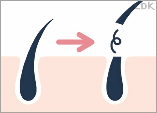 カミソリで剃ると毛深くなるってホント? 女性用電気シェーバーおすすめ イメージ
