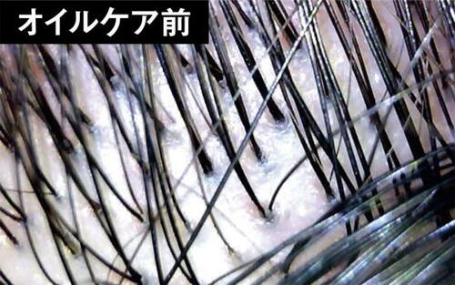 洗浄力の強いシャンプーではなくオイルケアで毛穴詰まりを解消!