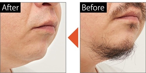 やわらかいヒゲもしっかり深剃りできる イメージ