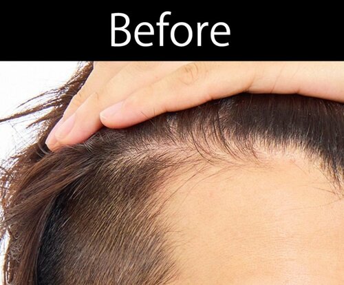 【仕上がり】わざとらしくなく地肌をカバーできた 増毛パウダーおすすめ イメージ3