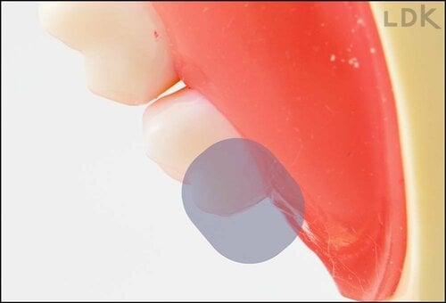 上奥歯の奥 歯ブラシおすすめ イメージ