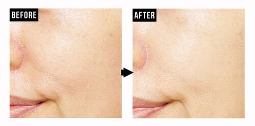 目立つ毛穴の補整もお手のもの！ ベージュ下地おすすめ イメージ