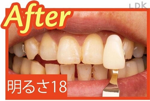 ▼After イメージ
