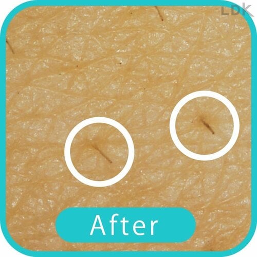 After 女性用電気シェーバーおすすめ イメージ