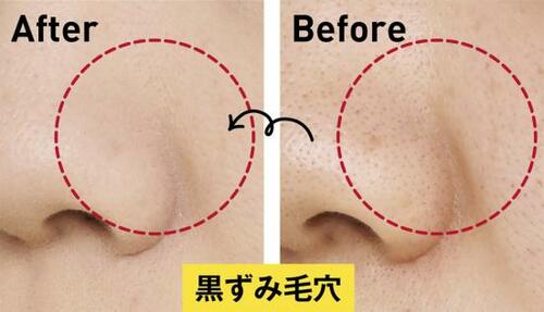 ロレアルなら厚塗り感なくふんわり自然に毛穴をカバー