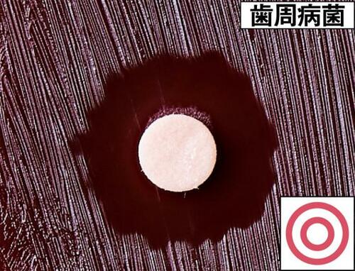 口臭対策に効果絶大!しっかり殺菌できました イメージ4