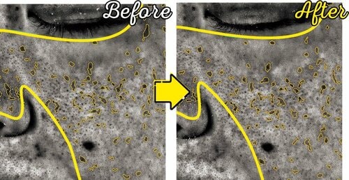 テスト1:毛穴ケア度 ビタミンC美容液おすすめ イメージ