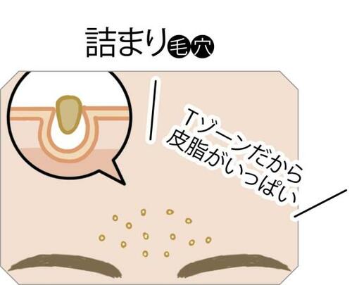 詰まり毛穴:まずはしっかり洗顔を! イメージ3