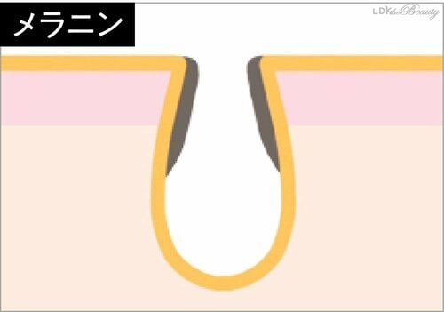 【メラニン】毛穴まわりがリング状に黒い 美容の裏ワザおすすめ イメージ