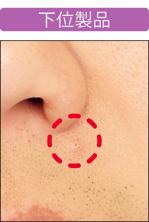 【ニキビ隠し】1回では隠れないが、重ね使いで隠せた メンズコンシーラーおすすめ イメージ3