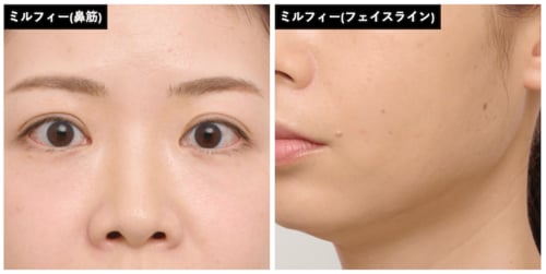 色白肌との相性はあと一歩 シェーディングおすすめ イメージ