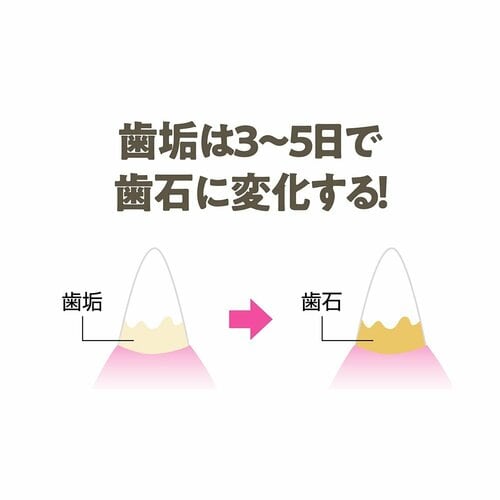 歯垢を放置していると歯周病のリスクがアップ！ 犬用歯磨きガムおすすめ イメージ
