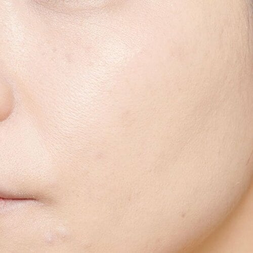 【仕上がり】シミは隠せるが毛穴カバーは苦手 美容誌ベスコスベースコスメおすすめ イメージ2