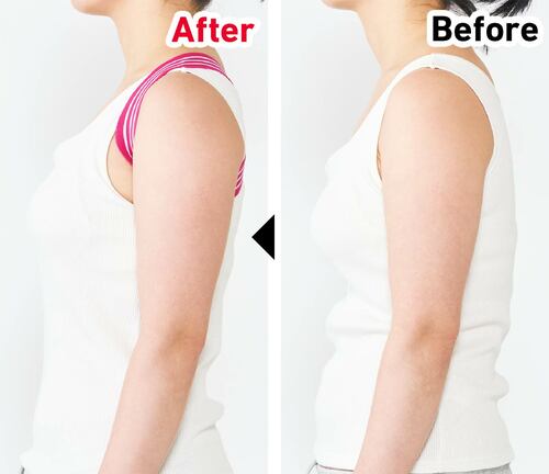 Before/After 猫背矯正ベルトおすすめ イメージ