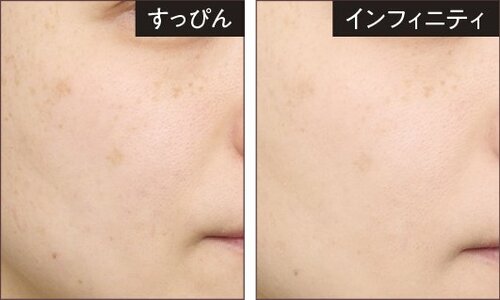 カバー力 2025年ベストコスメ ベースメイク部門おすすめ イメージ