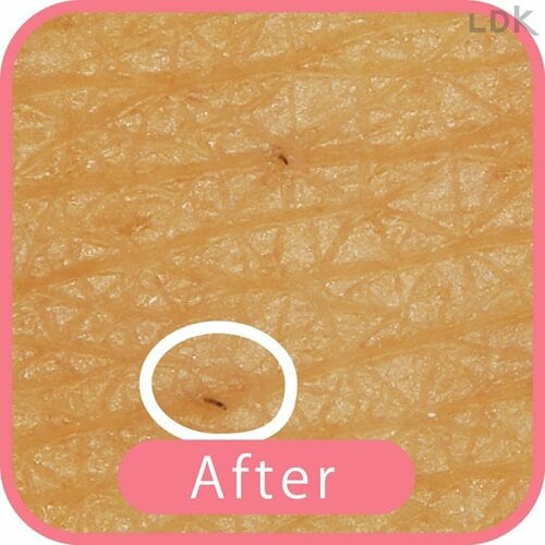 After 女性用T字カミソリおすすめ イメージ
