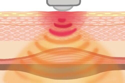肌にハリをもたらすRF(ラジオ波) 美顔器おすすめ イメージ