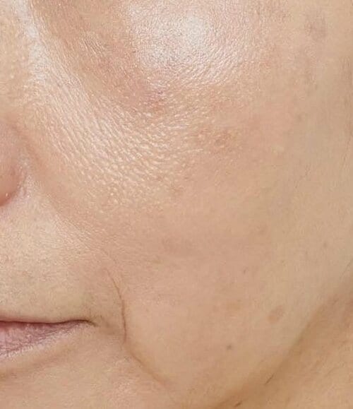白光りしたパールが毛穴に入り込む 50代・60代向けハイライトおすすめ イメージ