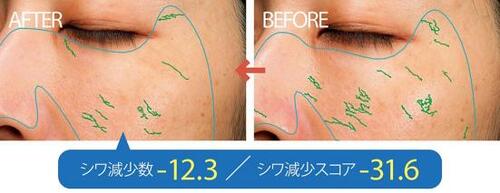 テスト1:しわ目立ち度
