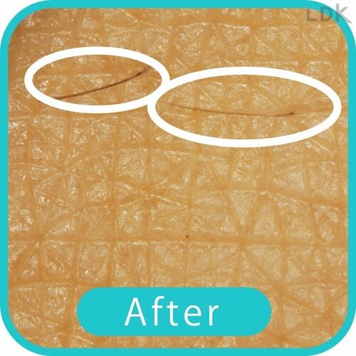 After 女性用電気シェーバーおすすめ イメージ