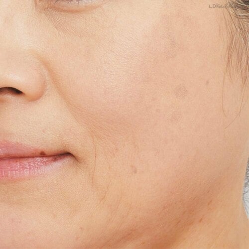 顔料が多めで毛穴に入り込みやすい 50代、60代向けファンデーションおすすめ イメージ
