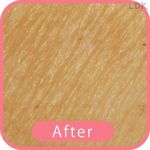 After 女性用T字カミソリおすすめ イメージ