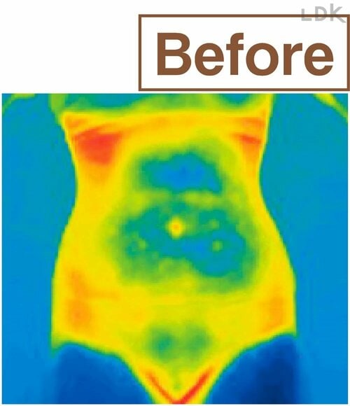 暖かさ：Before 腹巻パンツおすすめ イメージ