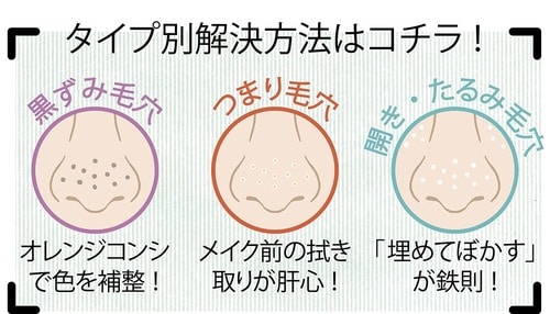 毛穴が目立ちすぎ事件、ついに解決! イメージ2