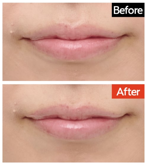 仕上がり：ツヤツヤにはなるもぷっくり感は弱い リッププランパーおすすめ イメージ