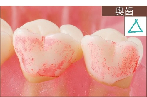 汚れ落ち：評価C イメージ6