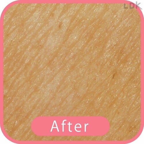 After 女性用T字カミソリおすすめ イメージ