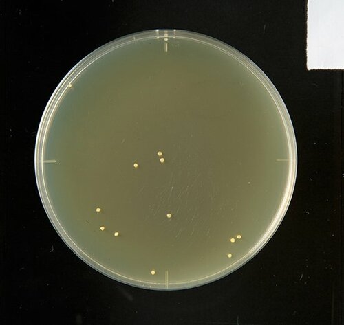【B評価】大腸菌は減らす 残念な結果のキュキュット イメージ