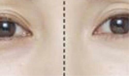 絶妙な色と光のバランスに美のプロも脱帽!! コンシーラーおすすめ イメージ
