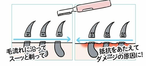 常に逆剃り＆同じ場所を何度も剃るとダメージに フェイスシェーバーおすすめ イメージ